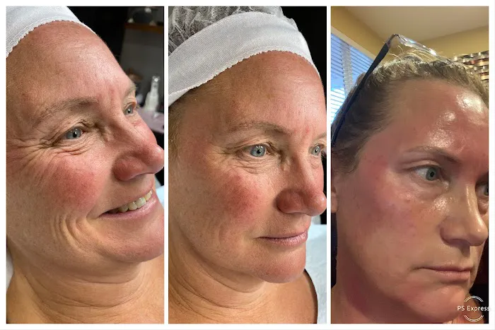 Cosmed-ttoo Picture 4