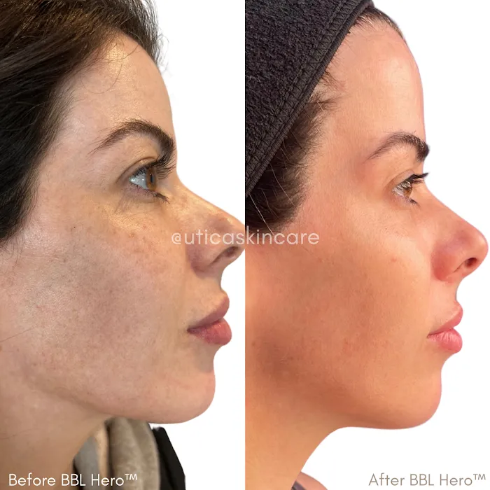 Utica Square Skin Care LLC Picture 9