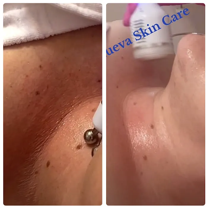 Renueva Skin Care LLC Picture 5