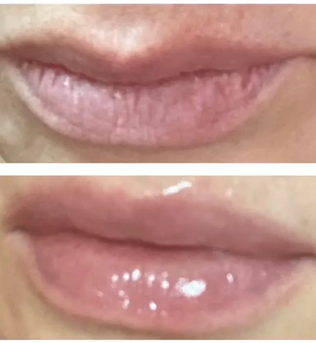 Renueva Skin Care LLC Picture 7