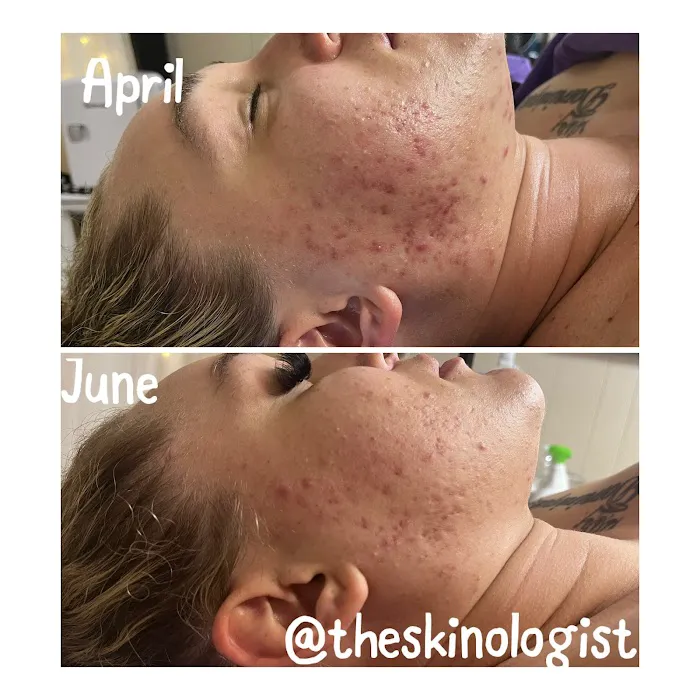 Ease Esthetics & Massage Picture 5