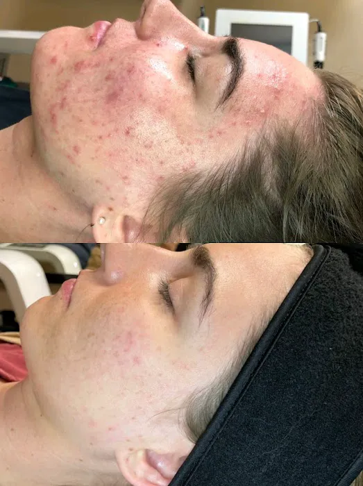 Reveal Skin Studio Picture 6