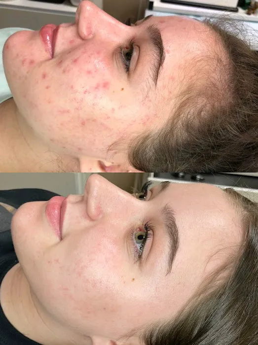 Reveal Skin Studio Picture 8