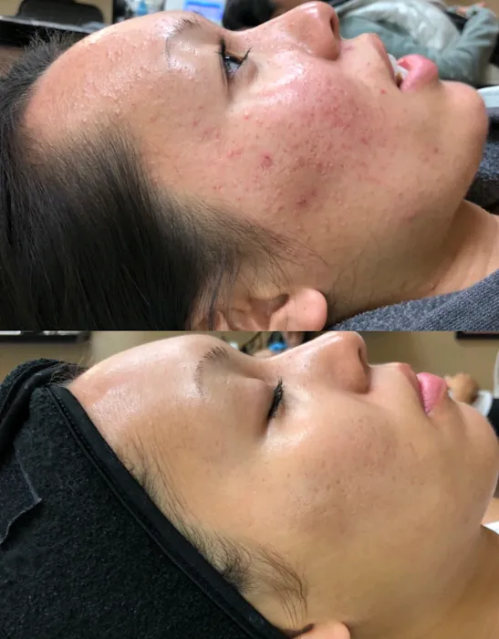 Reveal Skin Studio Picture 9