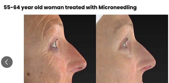 Derma Glow Collagen Stimulation Clinic Picture 3