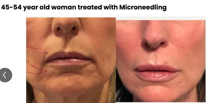 Derma Glow Collagen Stimulation Clinic Picture 4