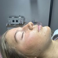 Addie Rose Esthetics ico