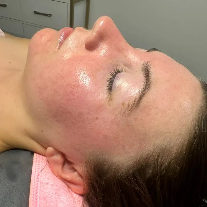 Addie Rose Esthetics Picture 9