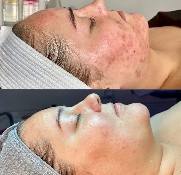 Lacquer Gallery SKIN Picture 6