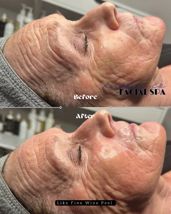 True Indigo Holistic Skincare Studio Picture 10