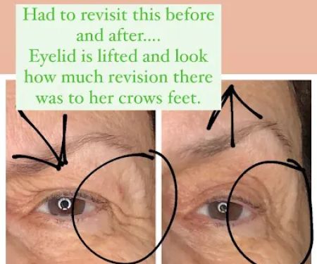 Simply Pure Skin Studio