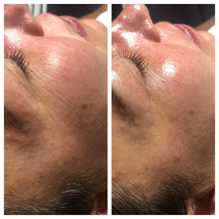 Simply Pure Skin Studio Picture 3