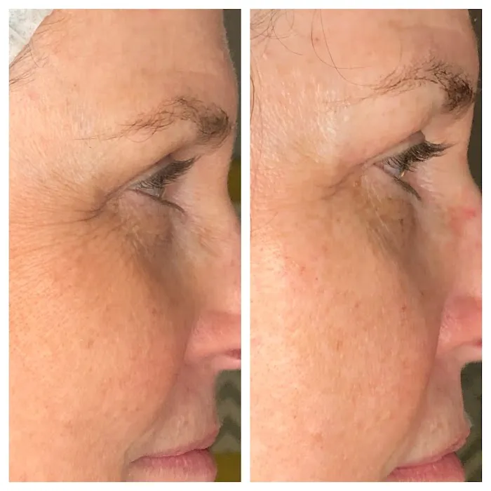 Simply Pure Skin Studio Picture 5