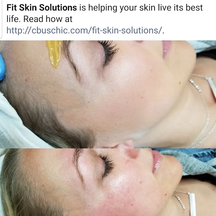 Fit Skin Solutions Picture 1