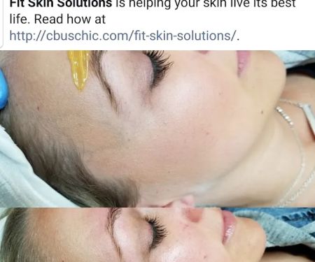 Fit Skin Solutions