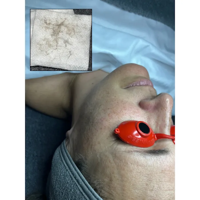 Elated Esthetics Picture 5