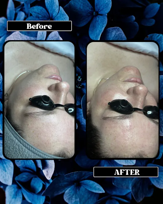 Elated Esthetics Picture 8