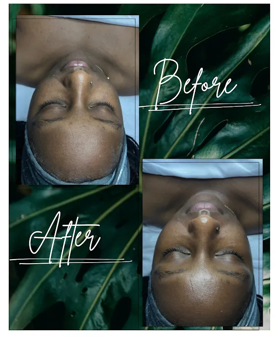 Elated Esthetics Picture 6