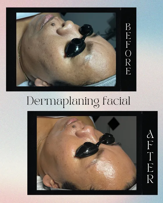 Elated Esthetics Picture 9