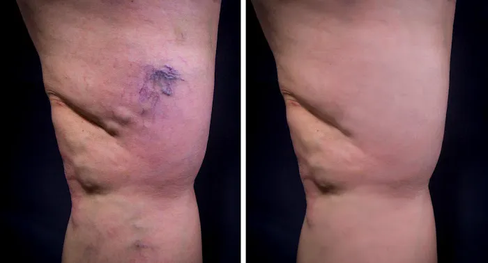 Artemis Body & Laser Picture 9