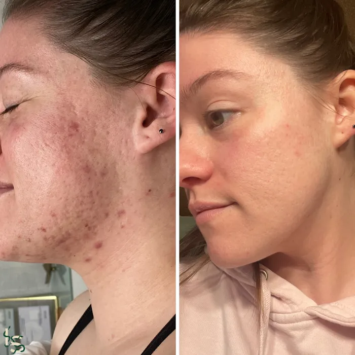 Leo + Sun Esthetics Picture 8