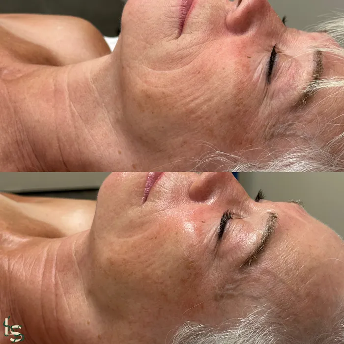 Leo + Sun Esthetics Picture 9