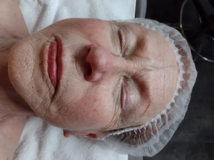 Skin By Samantha Picture 3