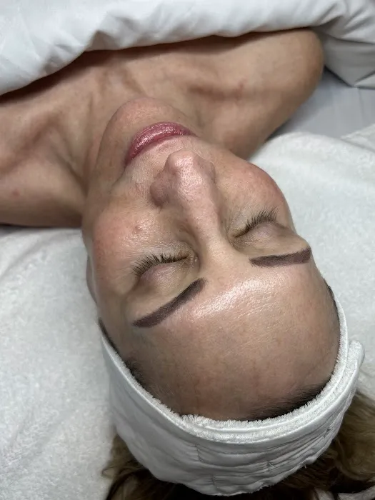 Rebecca Treats Skin Picture 5