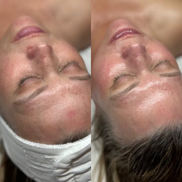 Rebecca Treats Skin Picture 3