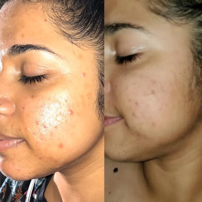 You Matter Beauty, a Skincare Studio Picture 4