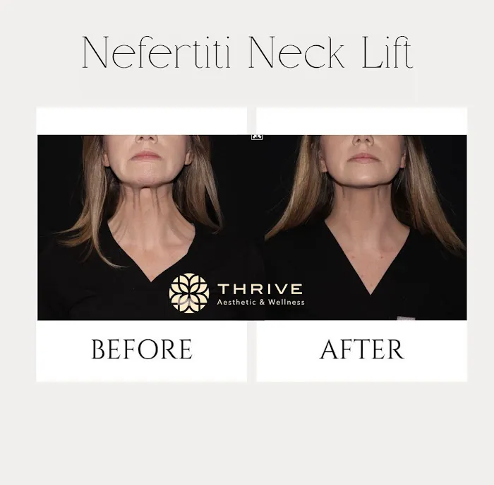 Thrive Aesthetic & Wellness Picture 3