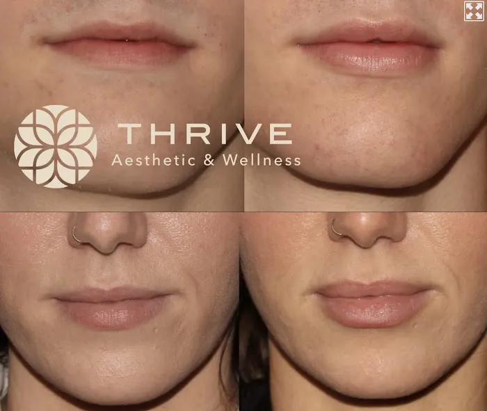 Thrive Aesthetic & Wellness Picture 2
