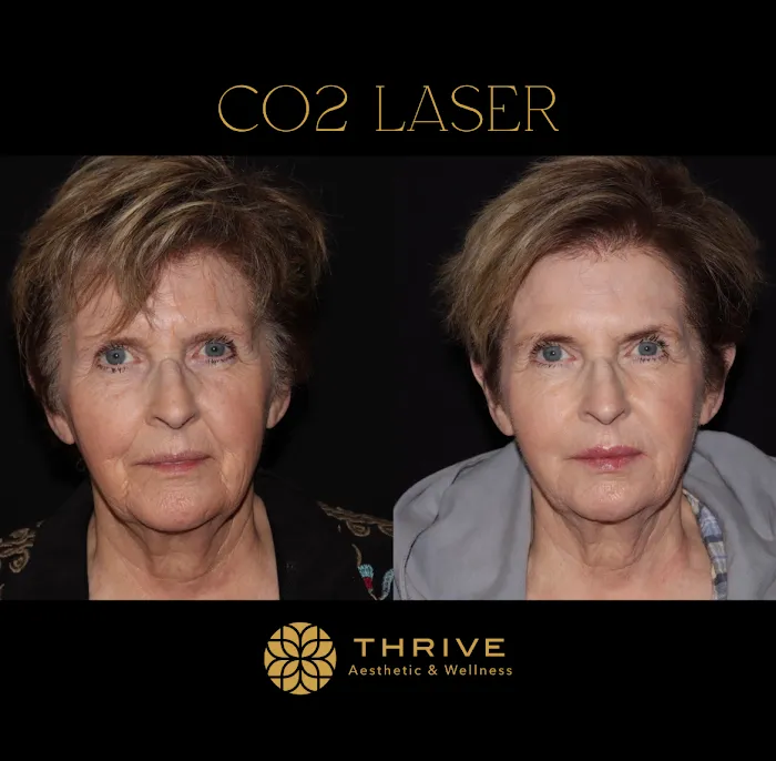 Thrive Aesthetic & Wellness Picture 9