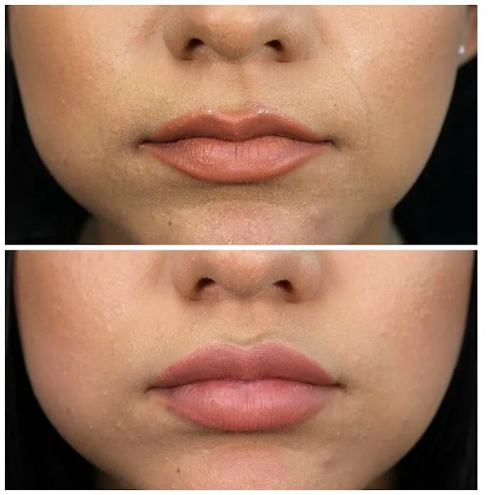 Thrive Aesthetic & Wellness Picture 7