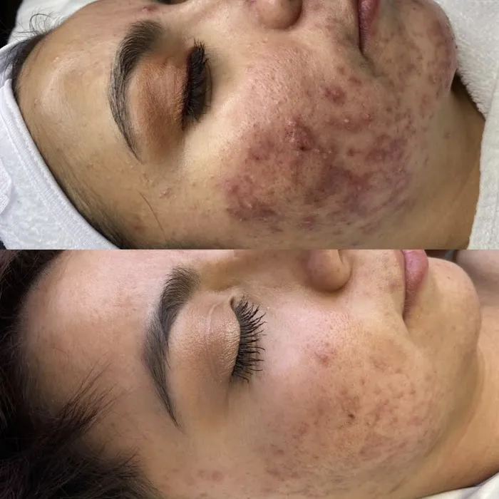 The Skin Series Picture 7