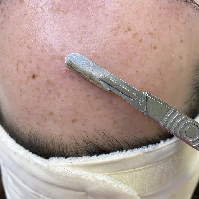 The Skin Series Picture 6