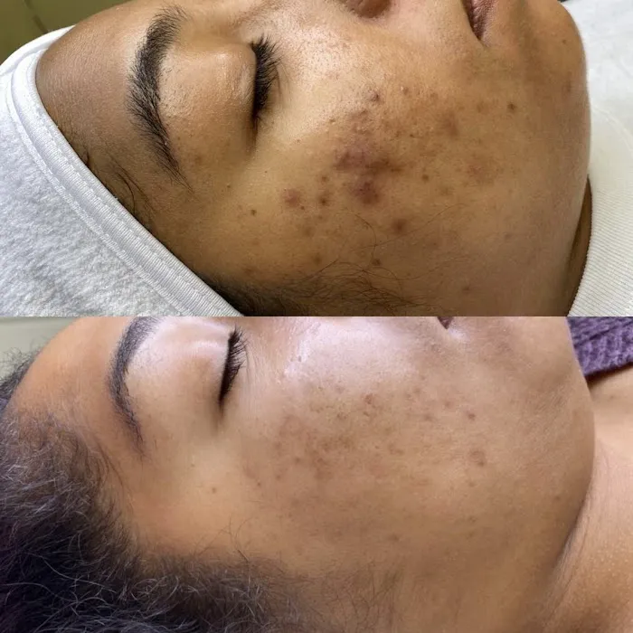 The Skin Series Picture 4