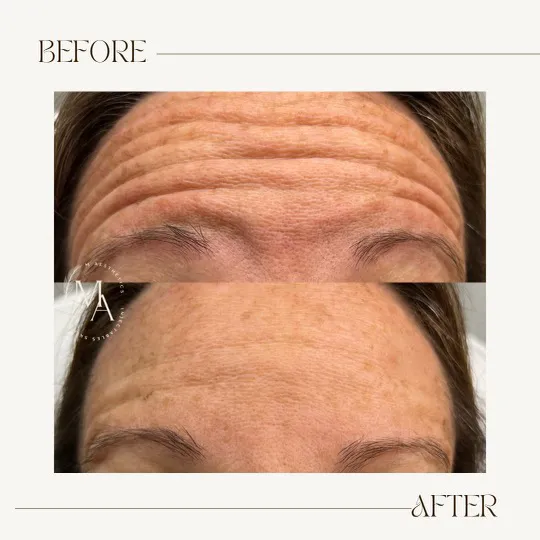 M Aesthetics Picture 2