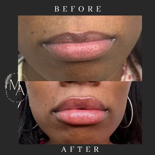 M Aesthetics Picture 8