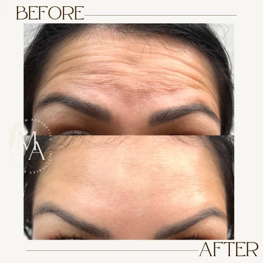 M Aesthetics Picture 9