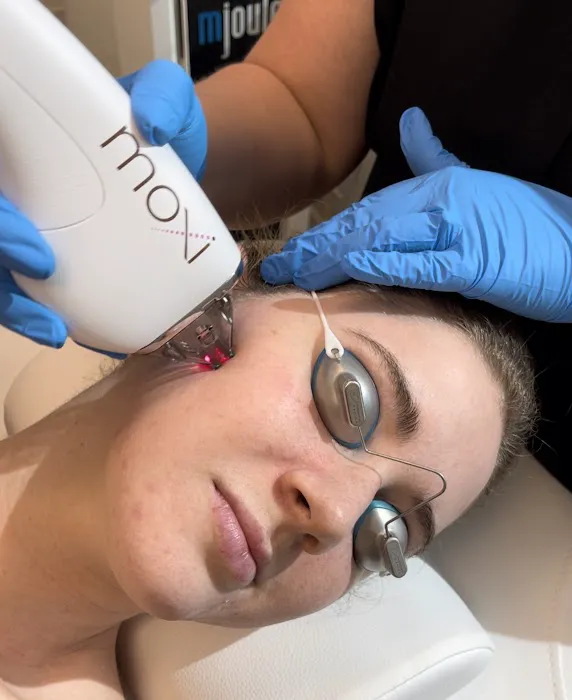 Beam Aesthetics Picture 8