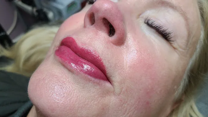 Nurture vs Nature Esthetic Enhancements Picture 10