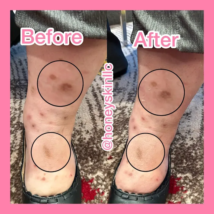 Honey Skin LLC Picture 4