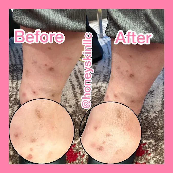 Honey Skin LLC Picture 7