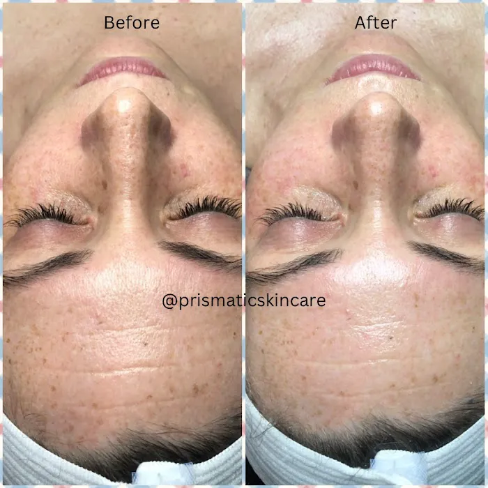 Prismatic Skincare Picture 8