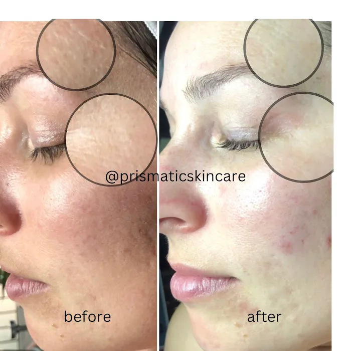 Prismatic Skincare Picture 5