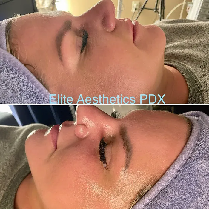 Elite Aesthetics PDX Picture 4