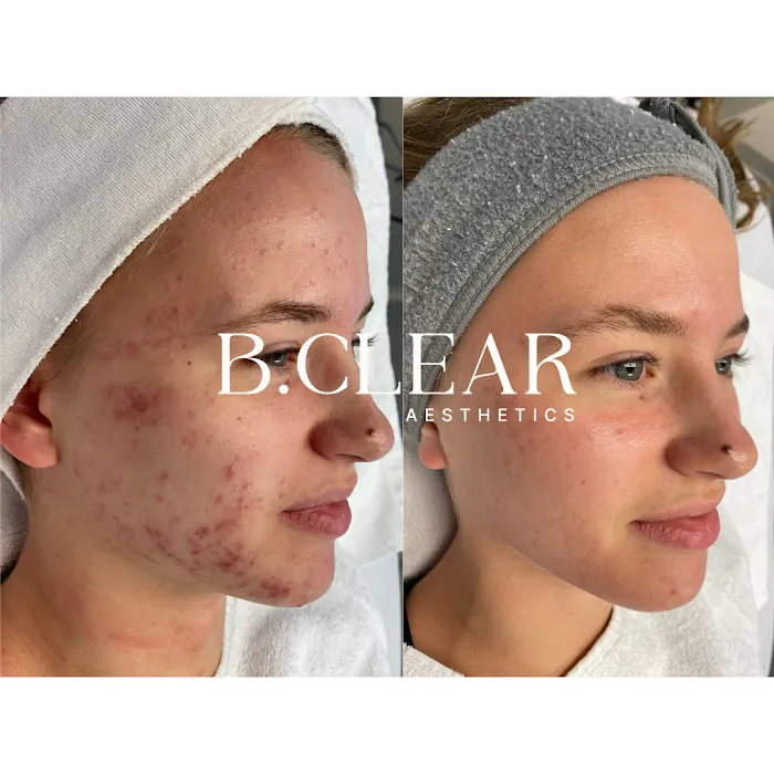 B.Clear Aesthetics Picture 10