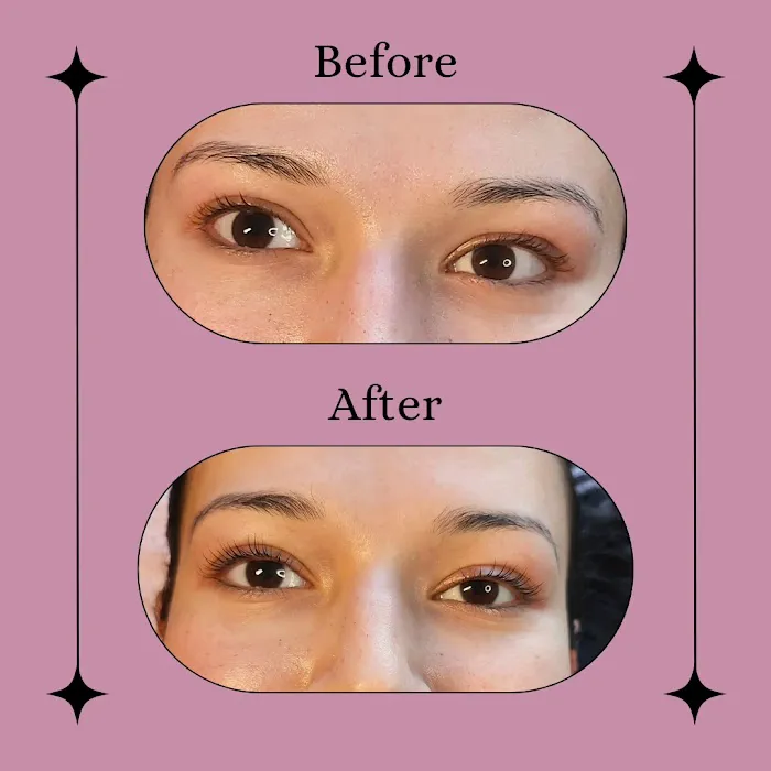 Crystal Vision Esthetics Picture 1