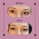 Crystal Vision Esthetics